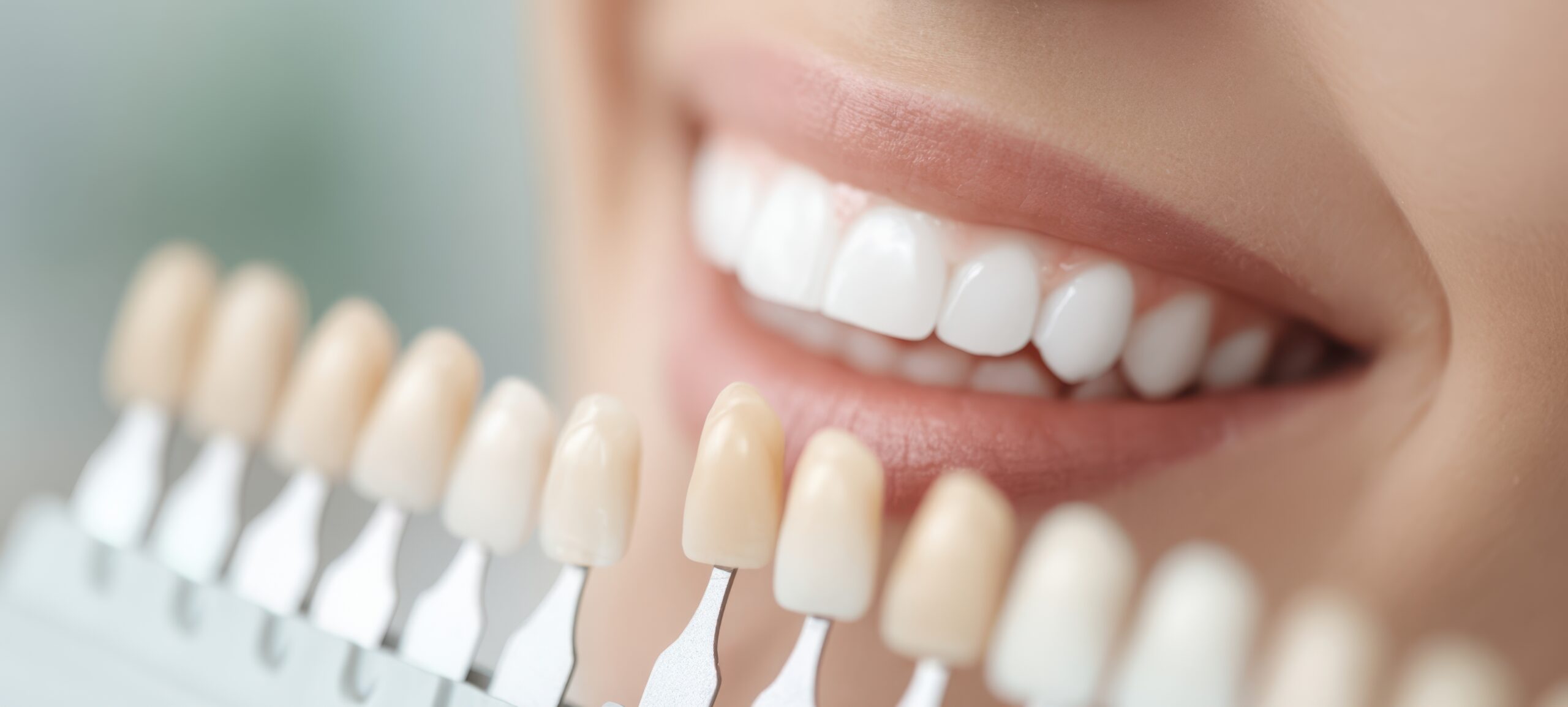The tooth shade guide held against a bright white smile for cosmetic dentistry